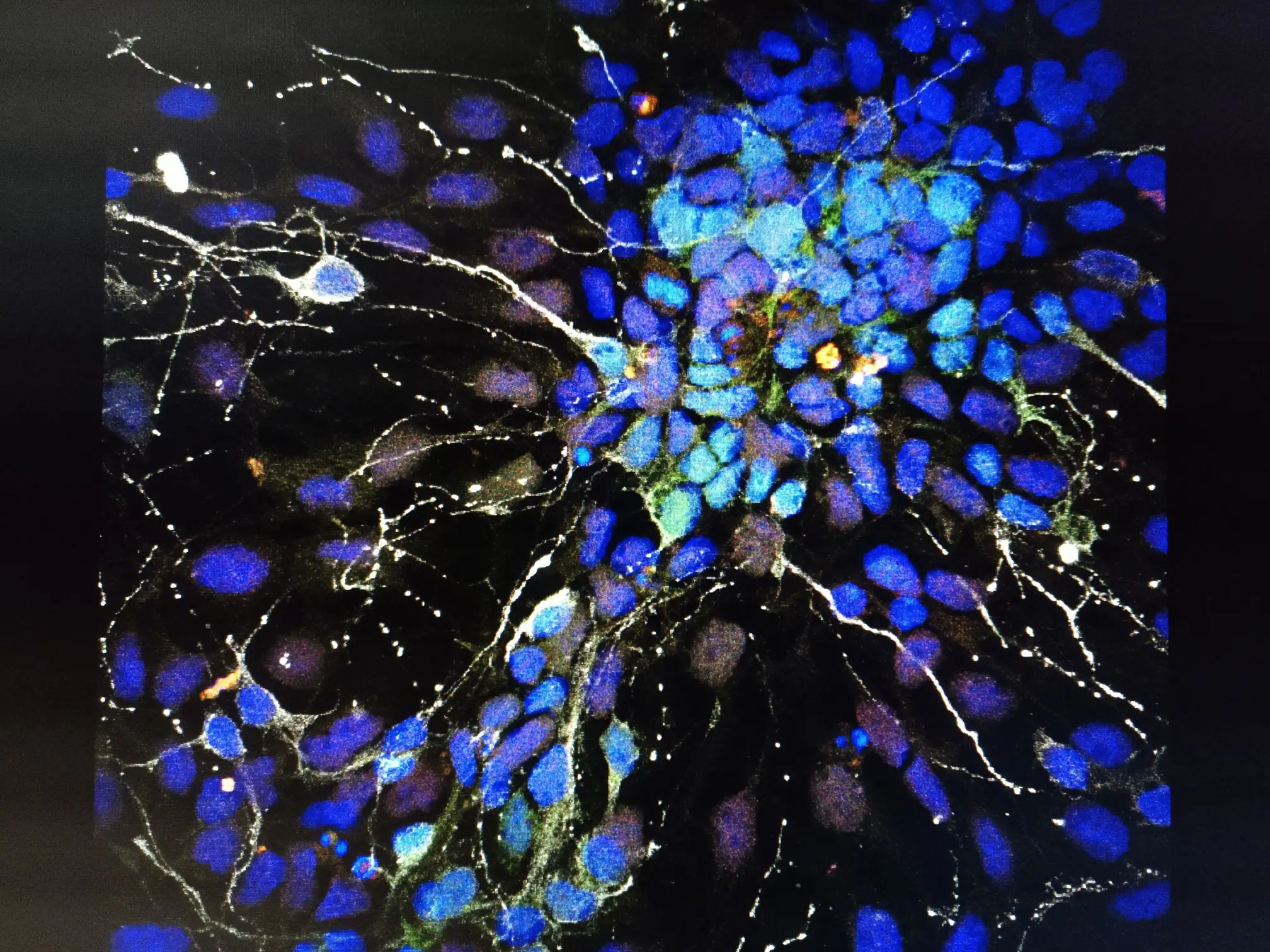 Dopaminergic neurons · 2019